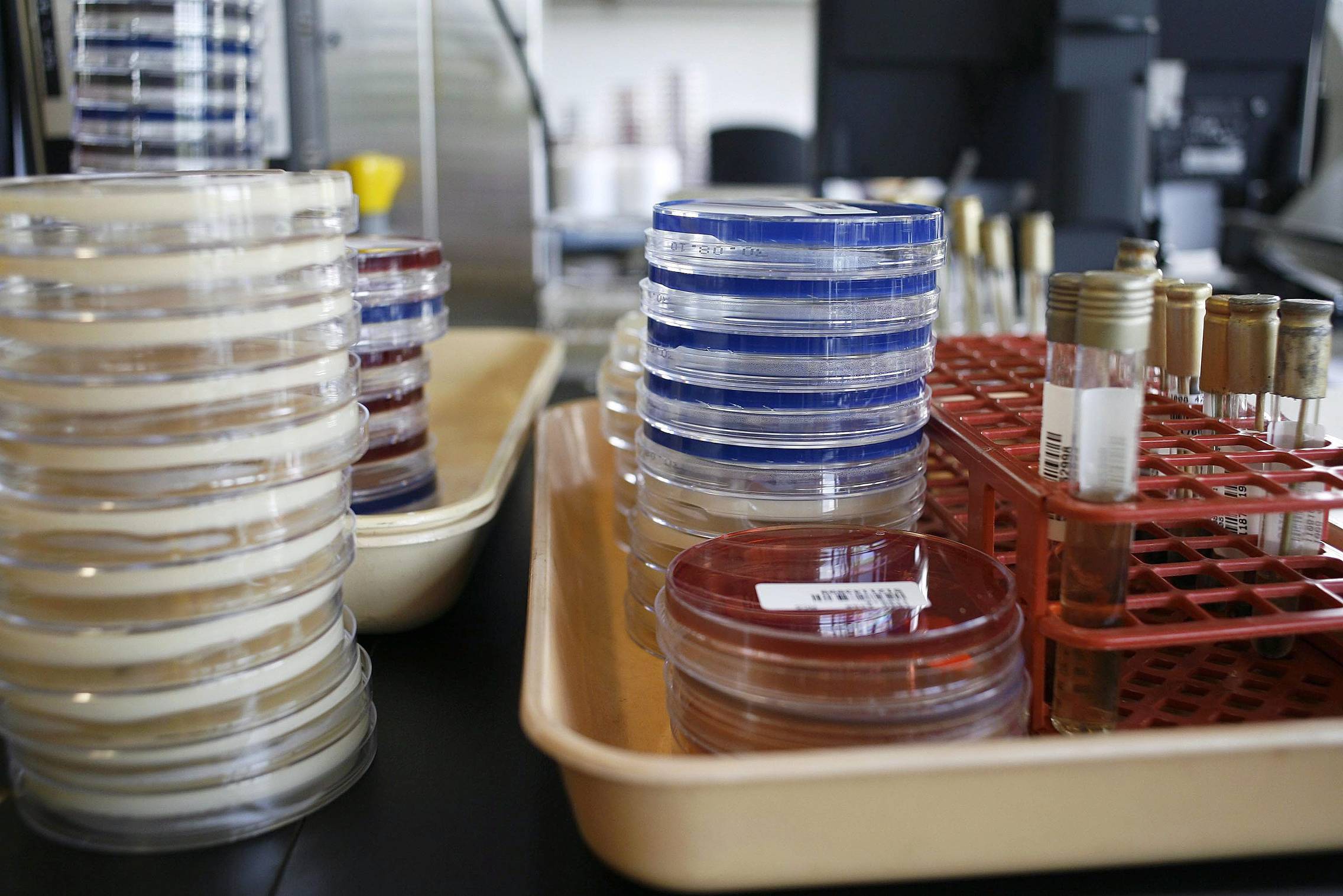 Foto: ALARMAN POR BACTERIA RESISTENTE NDM-1