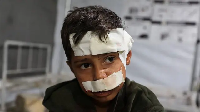 Niño con vendajes en la frente y la boca