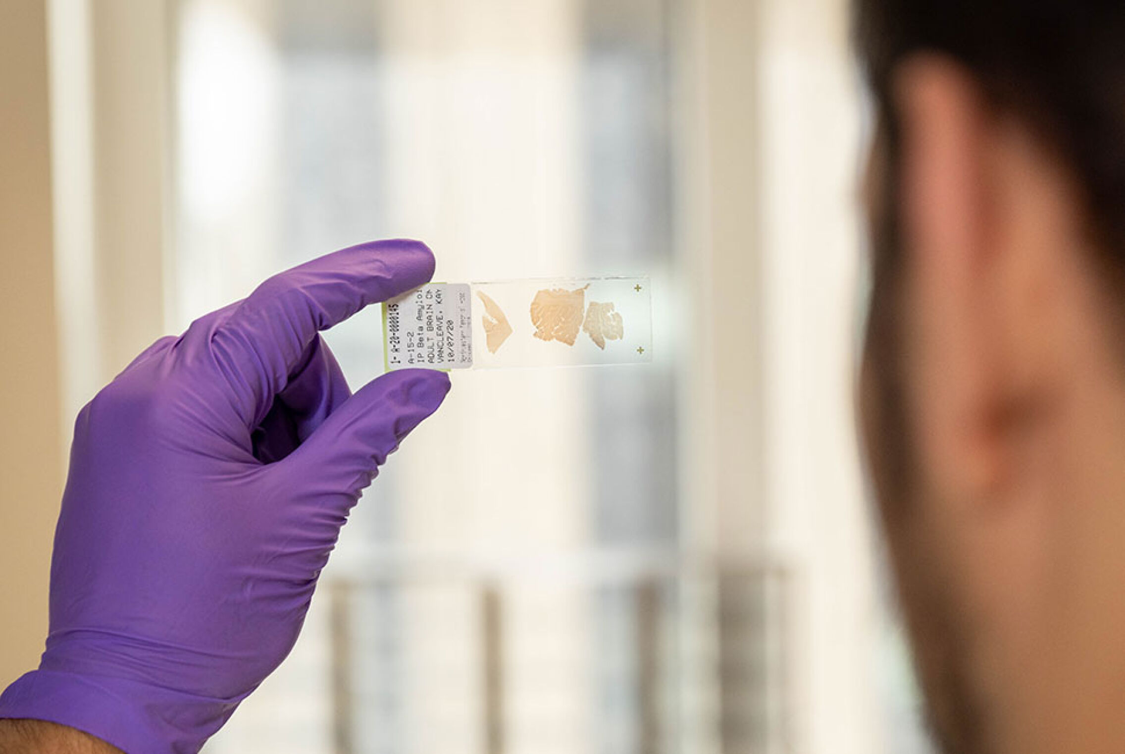 Foto: Portaobjetos de vidrio que contiene una lámina finísima de un cerebro. (EFE/Universidad Northwestern/Shane Collins)