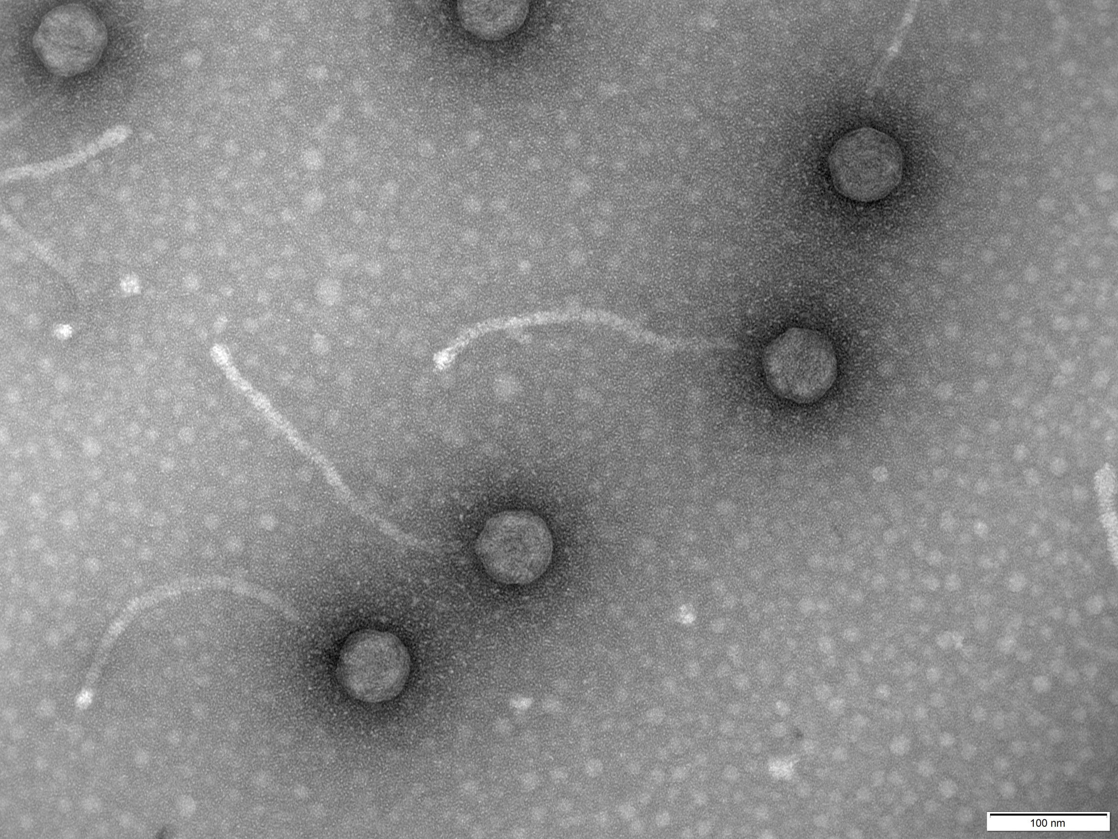 Foto: Micrografías de fagos. (EFE/Pilar Domingo-Calap)