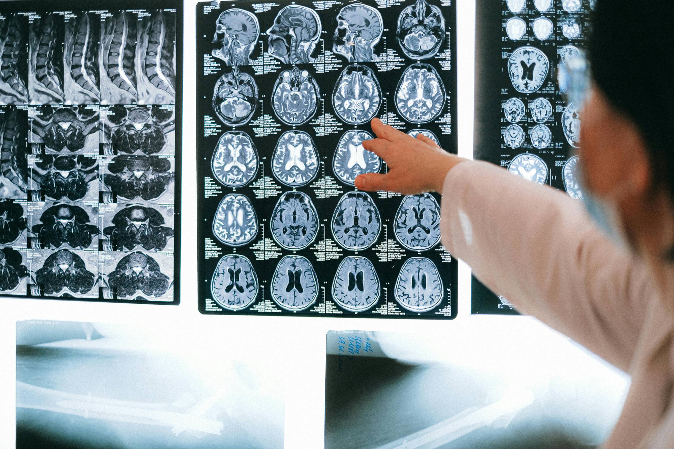 Desarrollar músculo y reducir la grasa visceral son objetivos prácticos, añaden los expertos (Pexels).