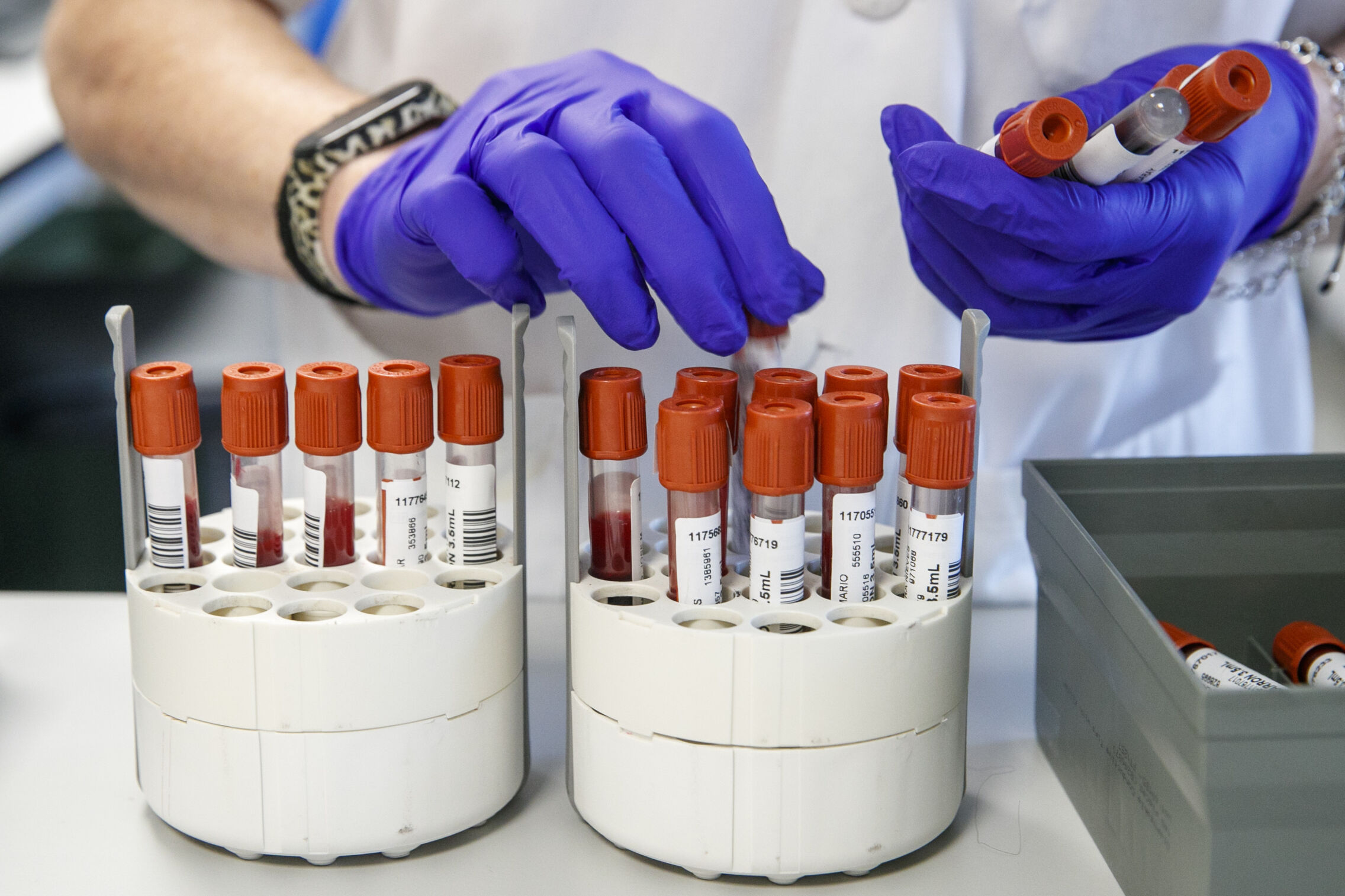 Foto: A pleno rendimiento en la cadena robotizada de serología en Zaragoza. (EFE / Javier Cebollada) 