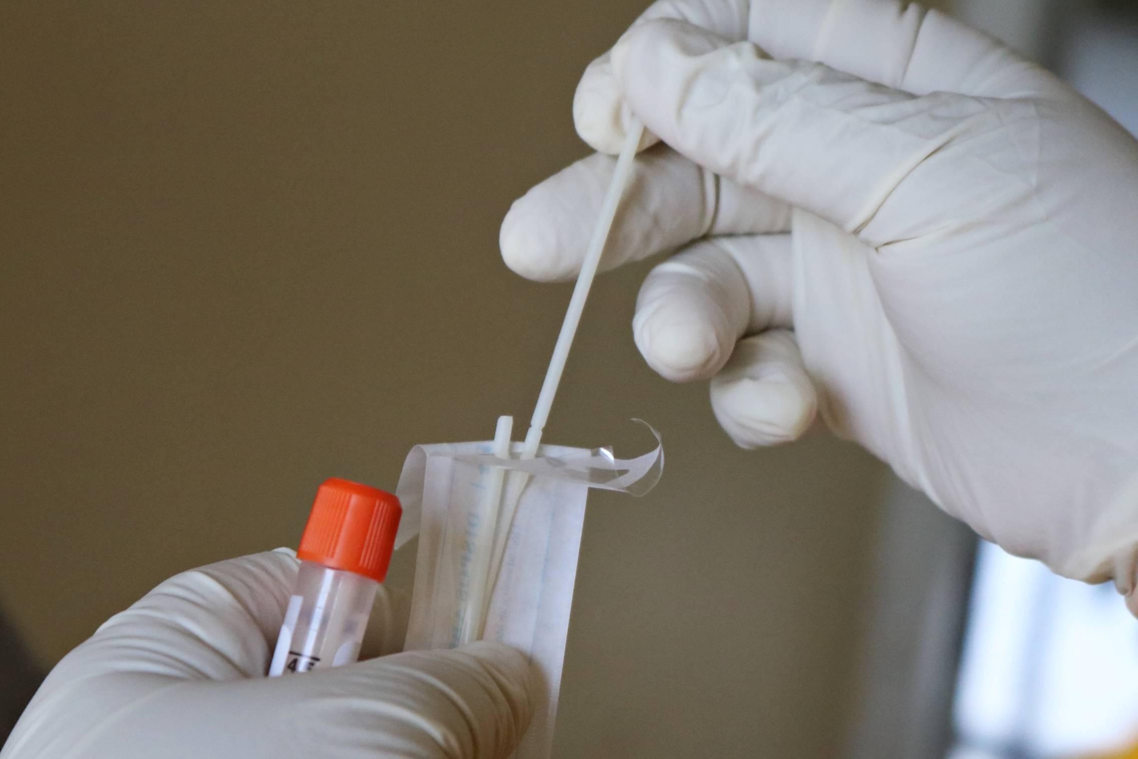 Foto: Un hisopo para la obtención de muestras. (Getty)