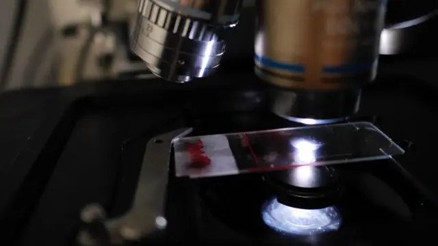 Un microscopio