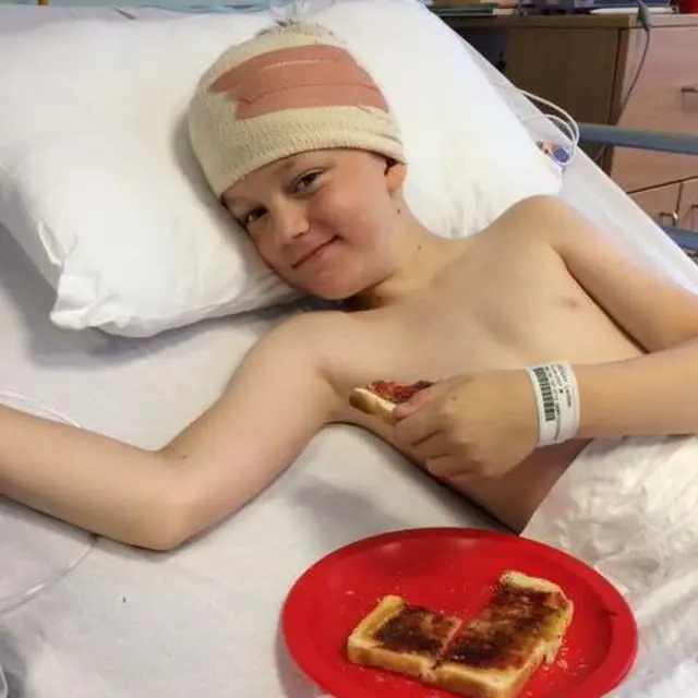 Un niño en una cama de hospital con la cabeza vendada. Junto a él, en la cama, hay un plato rojo y unas tostadas.