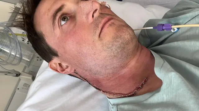 Anthony Perriam está sentado, mirando hacia otro lado, sin mirar a la cámara. Tiene una gran cicatriz de una operación que le recorre desde la oreja hasta la parte inferior del cuello.