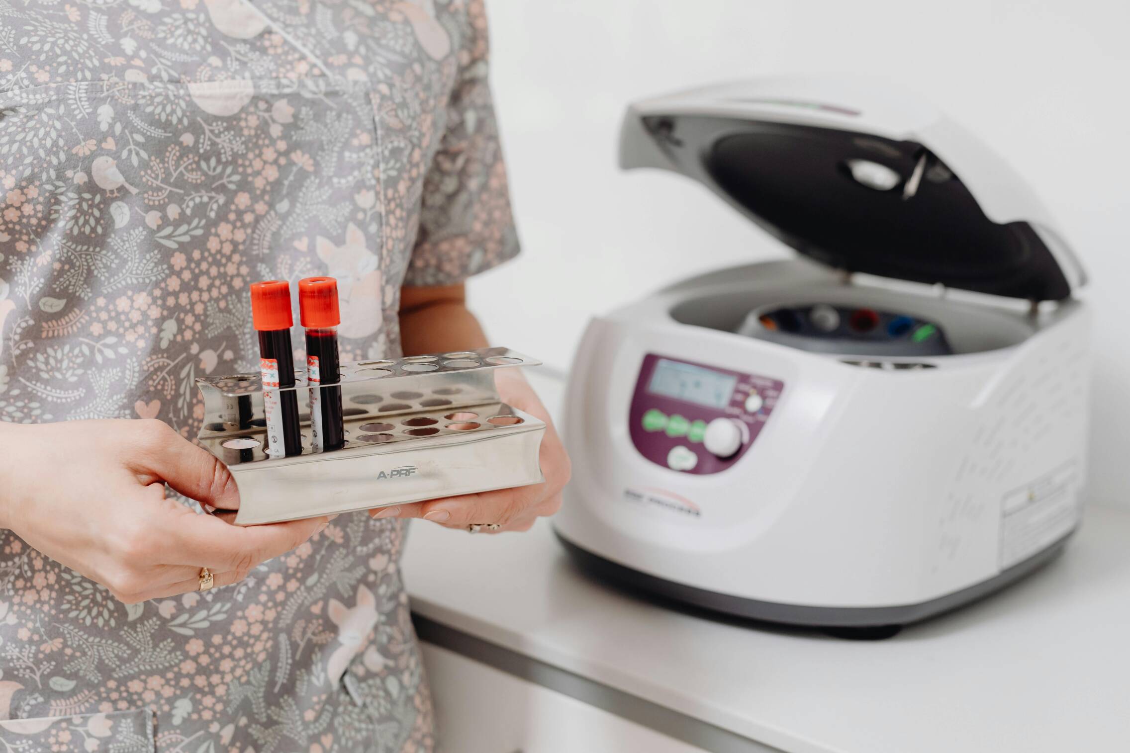 Foto: La dieta modifica el microbioma, y este modifica los metabolitos, clave en este análisis (Pexels).