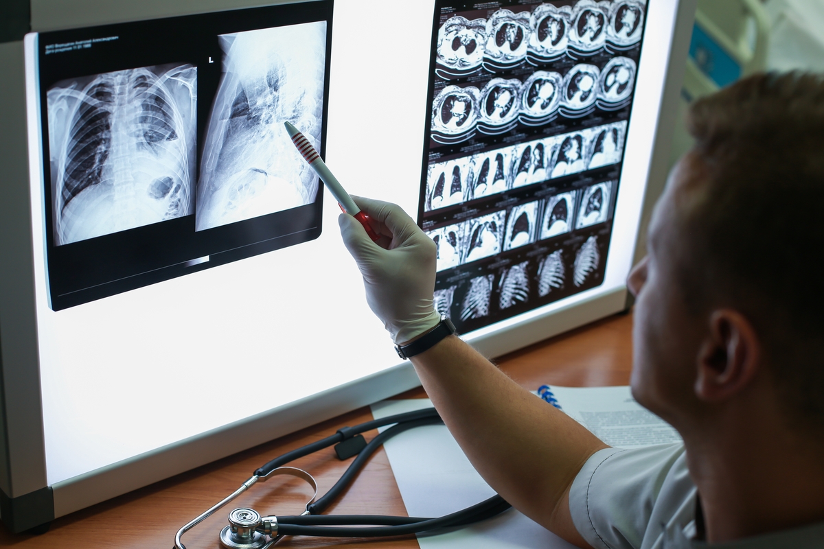 Un doctor observa una radiografía