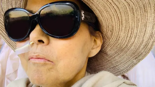 Con gafas de sol y un sombrero de ala ancha, Caroline permanece en el hospital con una sonda de alimentación en la fosa nasal derecha. Mientras espera un trasplante de hígado, su piel luce un tono amarillo claro.