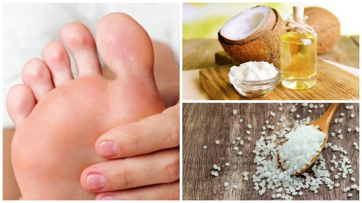 Aceite de coco en talones: la alternativa natural a las cremas que los podólogos recomiendan - image 1