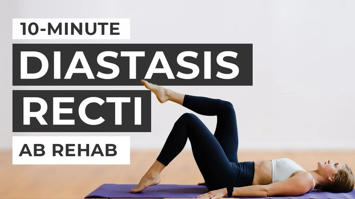 ¿Musculación o RPG para la diástasis? Descubre cuál te ayuda más a cerrar tu abdomen - image 1
