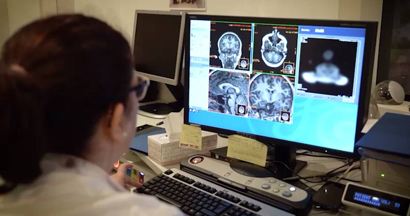 Foto: Estudios de cerebro (Foto: Fundación Cien)