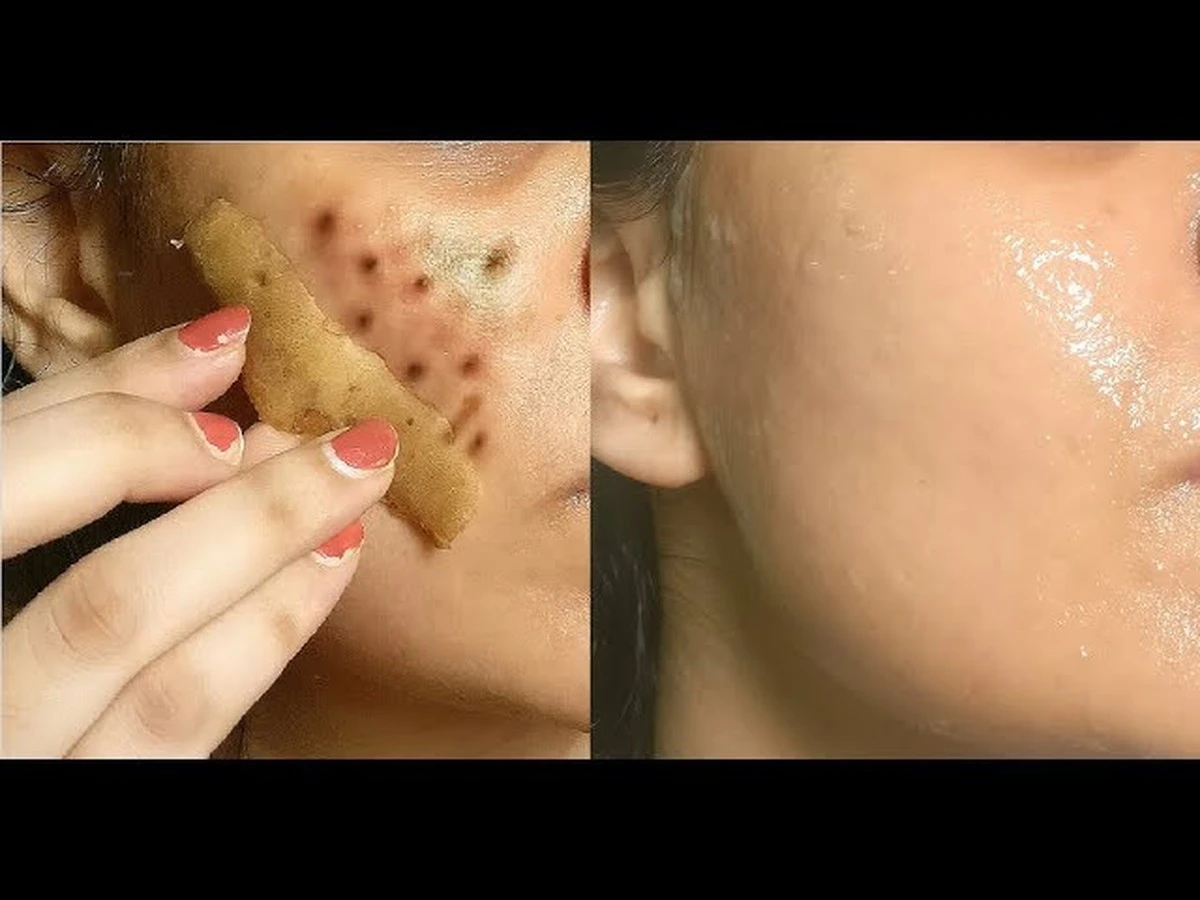 Adiós manchas oscuras: usé cáscaras de papa en mi rostro y el resultado me sorprendió - image 1