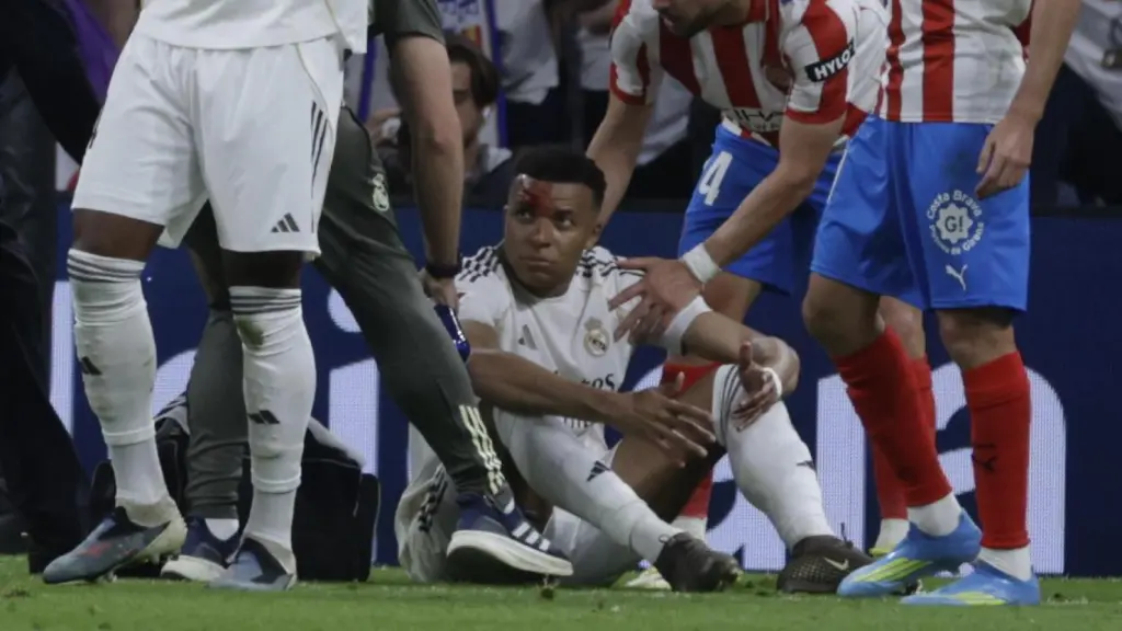 Mbappé, con sangre en la cara durante el partido ante el Girona
