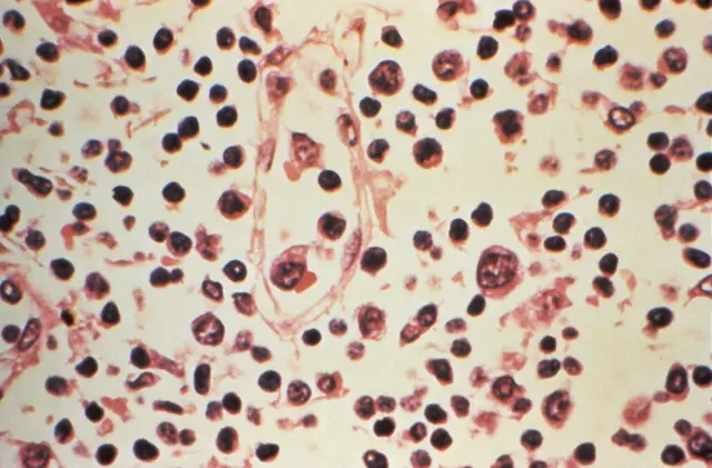 Muestra de hantavirus