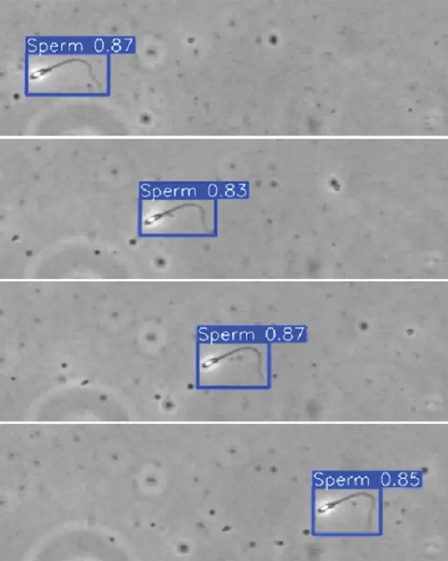 Imagen microscópica de espermatozoides marcados con recuadros y porcentajes de detección automática.