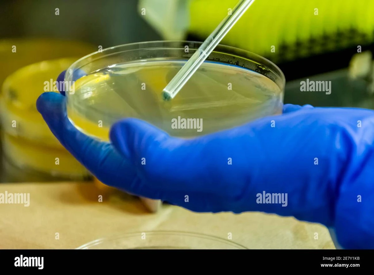 Alerta de Anvisa por bacterias en Ypê: no uses estos lotes específicos - image 1