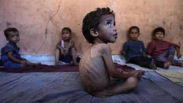 Yazan, un niño palestino de 2 años que sufre desnutrición, está sentado junto a sus hermanos en la vivienda familiar dañada, situada en el campo de refugiados de al Shati