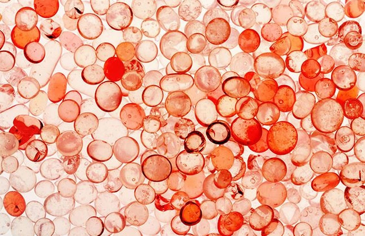 Adiós a la esponja mágica: el peligro del plástico y sus microplásticos en tu corazón - image 1