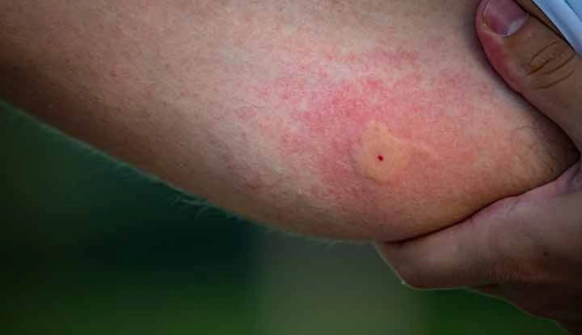 Adiós a los Mosquitos: el truco de la Lavanda que pocos activan bien - image 1