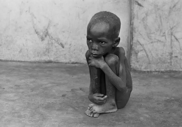 Un niño biafreño, famélico y desnudo, está sentado en una acera durante la Guerra Civil Nigeriana, el 25 de julio de 1968.