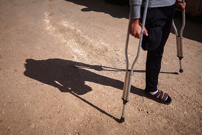 A Syrian man who lost his leg in a landmine explosion while harvesting olives walks outside his home in Qaminas, 9 April, 2025