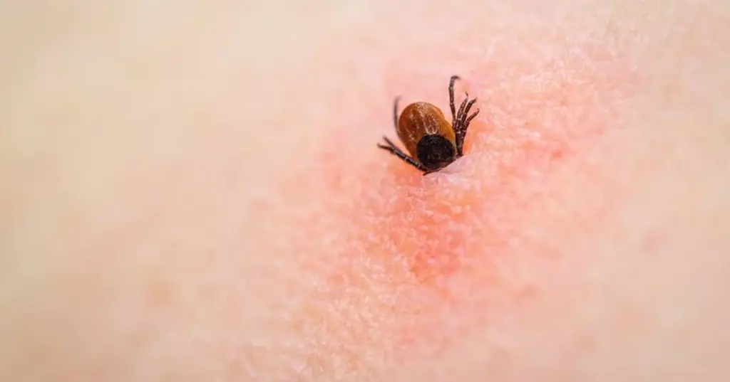 Adiós a las Garrapatas: el truco del suelo para evitar la Enfermedad de Lyme