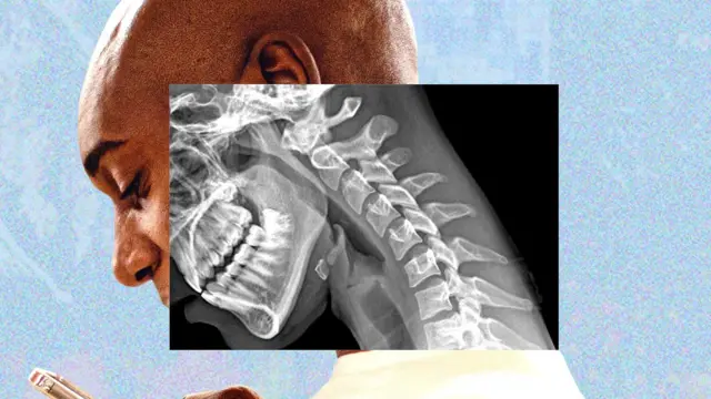 Un montaje en el que se ve a un hombre con la mirada hacia abajo, enfocado en la pantalla de su teléfono. Parte de su rostro se ve cono si fuera una radiografía en la que se ve su cuello estirado hacia adelante.